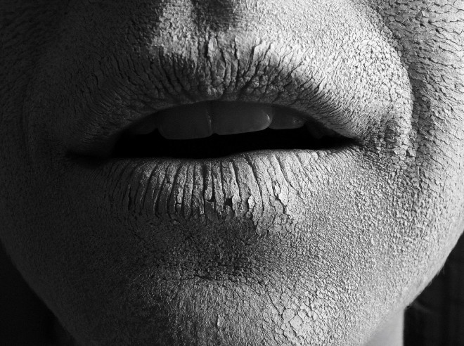 dry skin