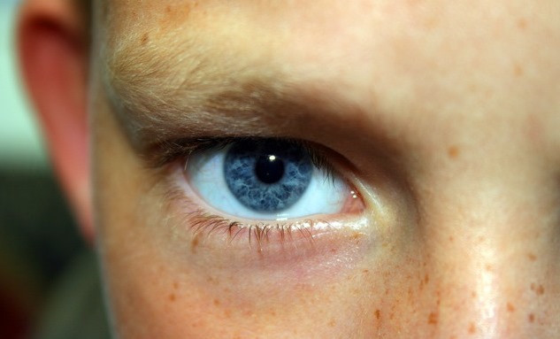 eye