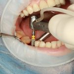 dental